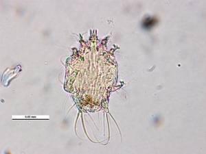 Tracheenmilbe (Acarapis woodi)